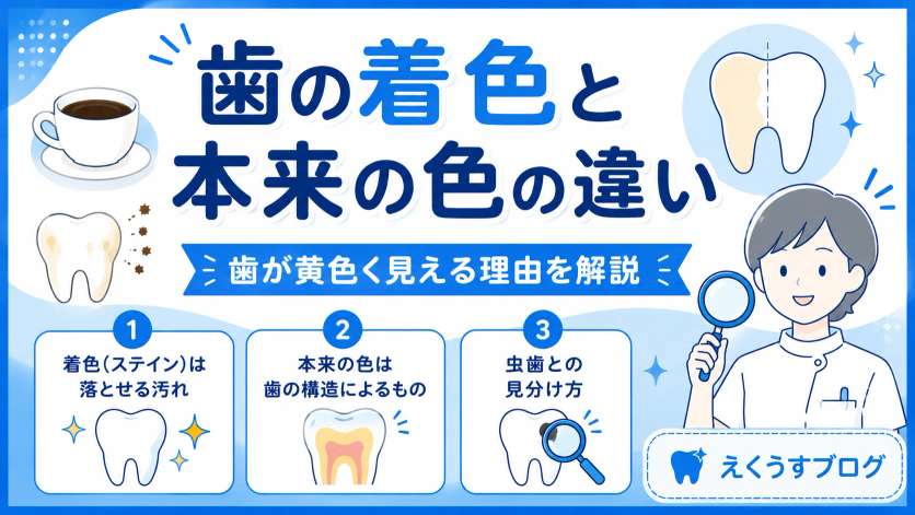 歯の着色と本来の色の違いを歯科衛生士が解説したアイキャッチ画像｜歯が黄色く見える理由やステインと本来の歯の色の違いを紹介