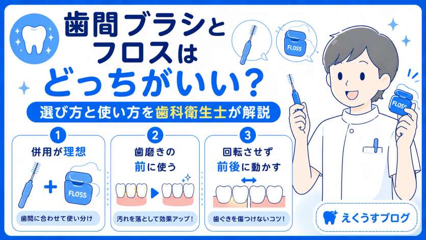 歯間ブラシとフロスはどっちがいい？選び方と使い方を歯科衛生士が解説したブログアイキャッチ画像