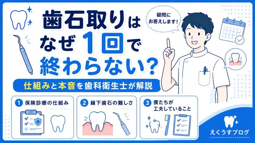 歯石取りはなぜ1回で終わらない？保険診療の仕組みや縁下歯石の難しさ、歯科衛生士が行っている工夫を現役歯科衛生士が解説したブログアイキャッチ画像